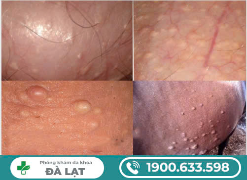 Hình ảnh minh họa